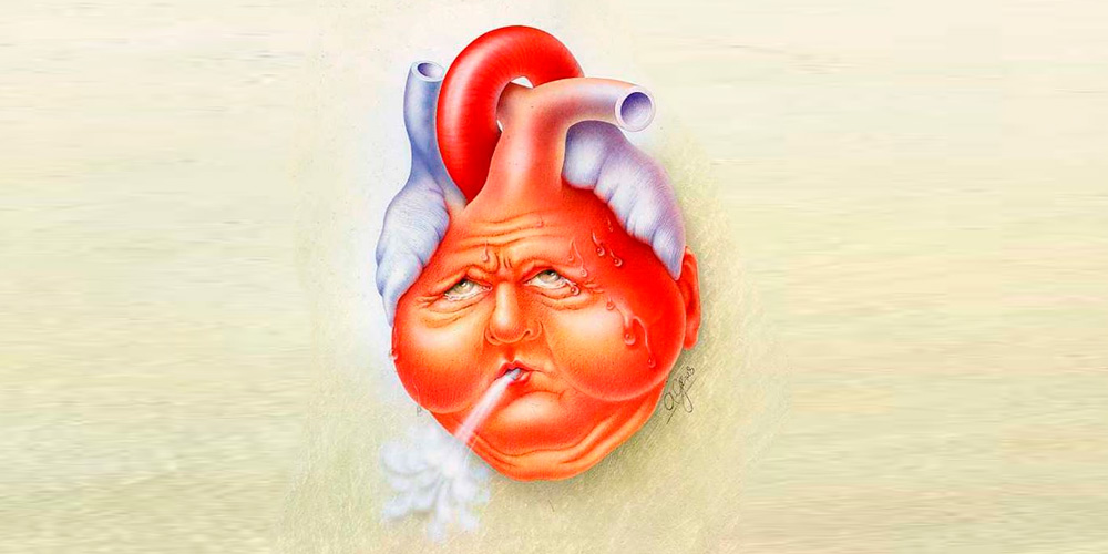 Отдаленные осложнения инфаркта миокарда