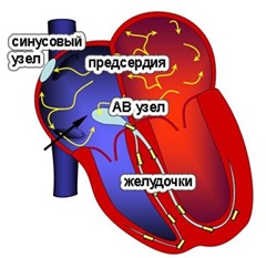 Читать статью полностью Что происходит в сердце при фибрилляции предсердий?